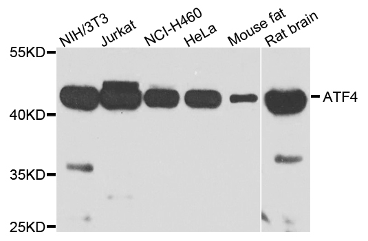 ATF4 Antibody - Western blot analysis of extract of various cells.