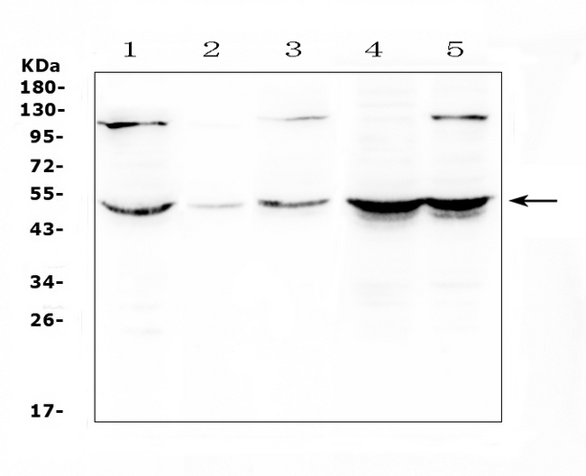 ATF4 Antibody - Western blot analysis of ATF4 using anti-ATF4 antibody. Electrophoresis was performed on a 5-20% SDS-PAGE gel at 70V (Stacking gel) / 90V (Resolving gel) for 2-3 hours. The sample well of each lane was loaded with 50ug of sample under reducing conditions. Lane 1: human Hela whole cell lysates,Lane 2: human placenta tissue lysates, Lane 3: human HepG2 whole cell lysates,Lane 4: human MDA-MB-231 whole cell lysates,Lane 5: human SW620 whole cell lysates. After Electrophoresis, proteins were transferred to a Nitrocellulose membrane at 150mA for 50-90 minutes. Blocked the membrane with 5% Non-fat Milk/ TBS for 1.5 hour at RT. The membrane was incubated with rabbit anti-ATF4 antigen affinity purified polyclonal antibody at 0.5 ?g/mL overnight at 4?C, then washed with TBS-0.1% Tween 3 times with 5 minutes each and probed with a goat anti-rabbit IgG-HRP secondary antibody at a dilution of 1:10000 for 1.5 hour at RT. The signal is developed using an Enhanced Chemiluminescent detection (ECL) kit with Tanon 5200 system. A specific band was detected for ATF4 at approximately 49KD. The expected band size for ATF4 is at 39KD.