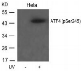ATF4 Antibody - Detection of ATF4 (phospho-Ser245) in extracts of HeLa cells untreated or treated with UV.