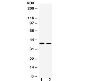 ATF4 Antibody - Western blot testing of human 1) U-2 OS and 2) SW620 cell lysate with ATF4 antibody at 0.5ug/ml. Predicted molecular weight ~39 kDa.