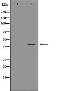 ATF4 Antibody - Western blot analysis of MCF-7 cell lysates using ATF4 antibody. The lane on the left is treated with the antigen-specific peptide.