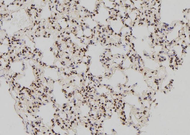 ATF4 Antibody - 1:100 staining rat lung tissue by IHC-P. The sample was formaldehyde fixed and a heat mediated antigen retrieval step in citrate buffer was performed. The sample was then blocked and incubated with the antibody for 1.5 hours at 22°C. An HRP conjugated goat anti-rabbit antibody was used as the secondary.