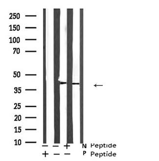 ATF4 Antibody - Western blot analysis of ATF4 (Phospho-Ser219) expression in A549 cells