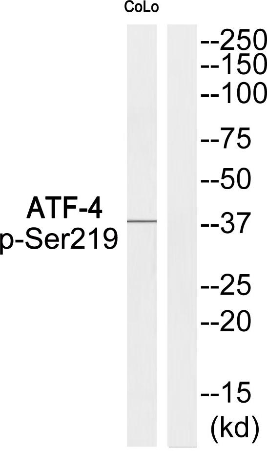 ATF4 Antibody - Western blot analysis of extracts from COLO205 cells, using ATF-4 (Phospho-Ser219) Antibody.