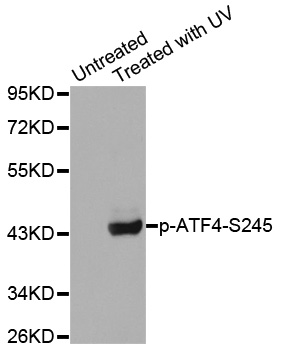 ATF4 Antibody - Western blot analysis of extracts from Hela cells.