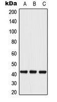 ATF4 Antibody - Western blot analysis of ATF4 (pS245) expression in MCF7 (A); mouse heart (B); rat heart (C) whole cell lysates.