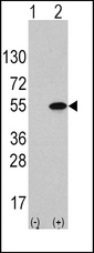 ATF4 Antibody - Western blot of ATF4 (arrow) using rabbit anti-ATF4 Antibody (S245). 293 cell lysates (2 ug/lane) either nontransfected (Lane 1) or transiently transfected with the ATF4 gene (Lane 2) (Origene Technologies).