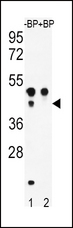 ATF4 Antibody - Western blot of ATF4 Antibody (S245) antibody pre-incubated without(lane 1) and with(lane 2) blocking peptide in WiDr cell line lysate. ATF4 Antibody (pS245) (arrow) was detected using the purified antibody.