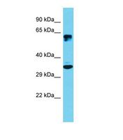 ATF5 Antibody - Western blot of Human HeLa. ATF5 antibody dilution 1.0 ug/ml.  This image was taken for the unconjugated form of this product. Other forms have not been tested.