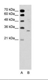 ATF5 Antibody - A: Marker, B: Jurkat Cell Lysate.