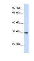 ATF5 Antibody - ATF5 antibody Western blot of Fetal Liver lysate. This image was taken for the unconjugated form of this product. Other forms have not been tested.