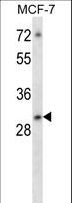 ATF5 Antibody - ATF5 Antibody western blot of MCF-7 cell line lysates (35 ug/lane). The ATF5 antibody detected the ATF5 protein (arrow).