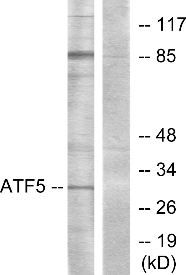 ATF5 Antibody - Western blot analysis of lysates from Jurkat cells, using ATF5 Antibody. The lane on the right is blocked with the synthesized peptide.