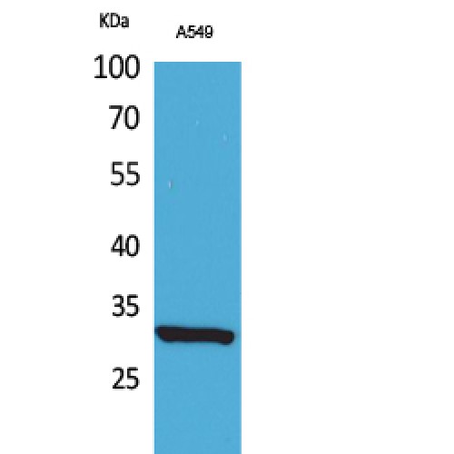 ATF5 Antibody - Western blot of Acetyl-ATF-5 (K29) antibody