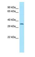 ATF5 Antibody - ATF5 antibody Western Blot of Rat Stomach.  This image was taken for the unconjugated form of this product. Other forms have not been tested.