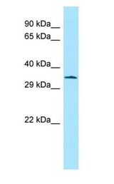 ATF5 Antibody - ATF5 antibody Western Blot of Rat Stomach.  This image was taken for the unconjugated form of this product. Other forms have not been tested.