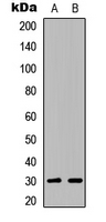 ATF5 Antibody - Western blot analysis of ATF5 expression in Jurkat (A); NIH3T3 (B) whole cell lysates.