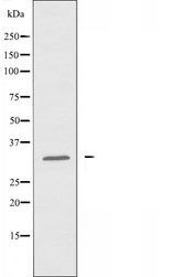 ATF5 Antibody - Western blot analysis of extracts of Jurkat cells using ATF5 antibody.