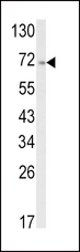 ATF6 Antibody - Western blot of ATF6 Antibody in A2058 cell line lysates (35 ug/lane). ATF6 (arrow) was detected using the purified antibody.