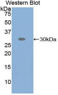 ATF6 Antibody - Western blot of recombinant ATF6.  This image was taken for the unconjugated form of this product. Other forms have not been tested.