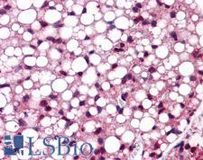 ATF6 Antibody - Anti-ATF6 antibody IHC of mouse adipose. Immunohistochemistry of formalin-fixed, paraffin-embedded tissue after heat-induced antigen retrieval. Antibody concentration 5 ug/ml.  This image was taken for the unconjugated form of this product. Other forms have not been tested.
