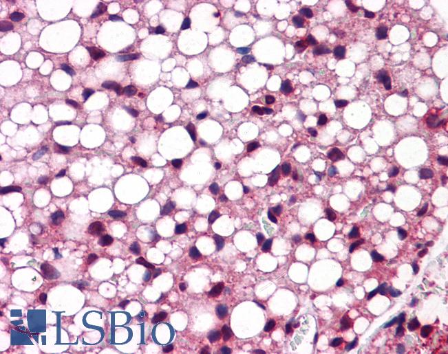 ATF6 Antibody - Anti-ATF6 antibody IHC of mouse adipose. Immunohistochemistry of formalin-fixed, paraffin-embedded tissue after heat-induced antigen retrieval. Antibody concentration 5 ug/ml.  This image was taken for the unconjugated form of this product. Other forms have not been tested.
