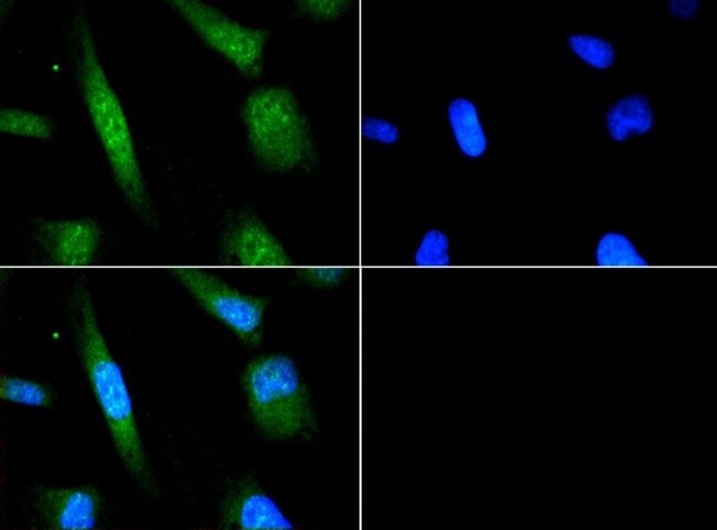 ATF6 Antibody - Immunocytochemistry/Immunofluorescence: ATF6 Antibody - Antibody was tested in HeLa cells with FITC (green). Nuclei were counterstained with Dapi (blue).  This image was taken for the unconjugated form of this product. Other forms have not been tested.