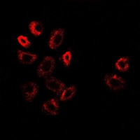 ATF6 Antibody - Immunofluorescent analysis of ATF6 staining in A549 cells. Formalin-fixed cells were permeabilized with 0.1% Triton X-100 in TBS for 5-10 minutes and blocked with 3% BSA-PBS for 30 minutes at room temperature. Cells were probed with the primary antibody in 3% BSA-PBS and incubated overnight at 4 deg C in a humidified chamber. Cells were washed with PBST and incubated with a DyLight 594-conjugated secondary antibody (red) in PBS at room temperature in the dark.
