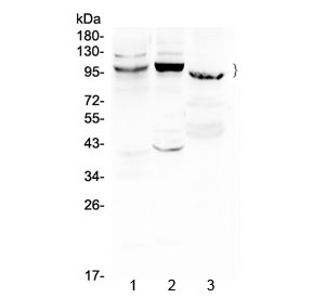 ATF6 Antibody - Western blot testing of 1) rat liver, 2) mouse liver and 3) human MCF7 cell lysate with ATF6 antibody at 0.5ug/ml. Predicted molecular weight ~75 kDa, rountinely observed at 90-100 kDa.
