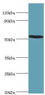 ATF7 Antibody - Western blot. All lanes: ATF7 antibody at 12 ug/ml+HeLa whole cell lysate. Secondary antibody: Goat polyclonal to rabbit at 1:10000 dilution. Predicted band size: 53 kDa. Observed band size: 53 kDa Immunohistochemistry.