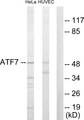 ATF7 Antibody - Western blot analysis of lysates from HeLa and HUVEC cells, using ATF7 Antibody. The lane on the right is blocked with the synthesized peptide.