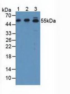 ATF7 Antibody - Western Blot; Sample: Lane1: Human SGC7901 Cells; Lane2: Human Hela Cells; Lane3: Rat Stomach Tissue