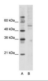 ATF7 Antibody - A: Marker, B: Jurkat Cell Lysate.  This image was taken for the unconjugated form of this product. Other forms have not been tested.