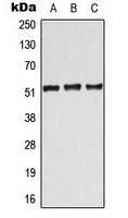 ATF7 Antibody - Western blot analysis of ATF7 expression in Jurkat (A); Raw264.7 (B); rat brain (C) whole cell lysates.