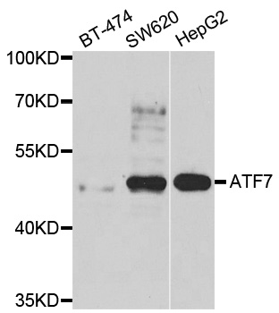 ATF7 Antibody - Western blot analysis of extracts of various cell lines.