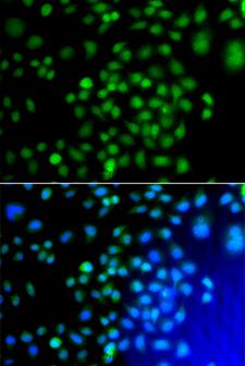 ATF7 Antibody - Immunofluorescence analysis of A549 cells.