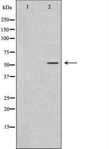 ATF7 Antibody - Western blot analysis of extracts of HeLa cells using ATF7 antibody. The lane on the left is treated with the antigen-specific peptide.