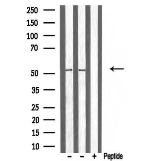 ATF7 Antibody - Western blot analysis of extracts of various tissue sample using ATF7 antibody.