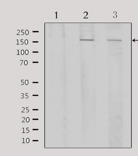 ATF7 Antibody - Western blot analysis of extracts of various samples using ATF7 antibody. Lane 1: 293 treated with blocking peptide; Lane 2: 293; Lane 3: mouse brain;