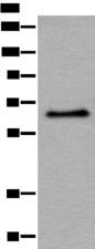 ATF7 Antibody - Western blot analysis of Hela cell lysate  using ATF7 Polyclonal Antibody at dilution of 1:500