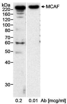 ATF7IP / MCAF1 Antibody - Detection of Human MCAF by Western Blot. Samples: Nuclear extract (20 ug) from HeLa cells. Antibody: Affinity purified rabbit anti-MCAF antibody used at 0.2 and 0.1 ug/ml. Detection: Chemiluminescence with an exposure time of 15 minutes.