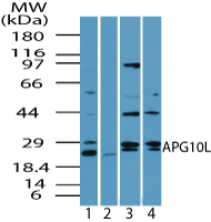 ATG10 Antibody - Western blot of APG10L in human brain lysate in the 1) absence and 2) presence of immunizing peptide 3) mouse brain and 4) rat brain using Polyclonal Antibody to APG10L at 2.0 ug/ml, 6.0 ug/ml and 4.0 ug/ml, respectively. Goat anti-rabbit Ig HRP secondary antibody, and PicoTect ECL substrate solution, were used for this test.