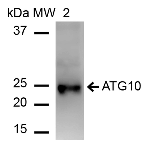 ATG10 Antibody - Western blot analysis of Human Embryonic kidney epithelial cell line (HEK293) lysate showing detection of ~25.3 kDa ATG10 protein using Rabbit Anti-ATG10 Polyclonal Antibody. Lane 1: Molecular Weight Ladder (MW). Lane 2: Hek293T cell lysates. Load: 15 µg. Block: 5% Skim Milk in 1X TBST. Primary Antibody: Rabbit Anti-ATG10 Polyclonal Antibody  at 1:1000 for 60 min at RT. Secondary Antibody: Goat Anti-Rabbit IgG: HRP at 1:2000 for 60 min at RT. Color Development: ECL solution for 6 min in RT. Predicted/Observed Size: ~25.3 kDa.