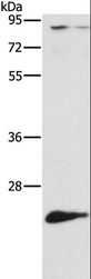 ATG10 Antibody - Western blot analysis of Mouse liver tissue, using ATG10 Polyclonal Antibody at dilution of 1:500.