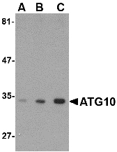 ATG10 Antibody - Western blot of ATG10 in SK-N-SH cell lysate with ATG10 antibody at (A) 0.5, (B) 1 and (C) 2 ug/ml.