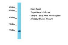 ATG101 Antibody -  This image was taken for the unconjugated form of this product. Other forms have not been tested.