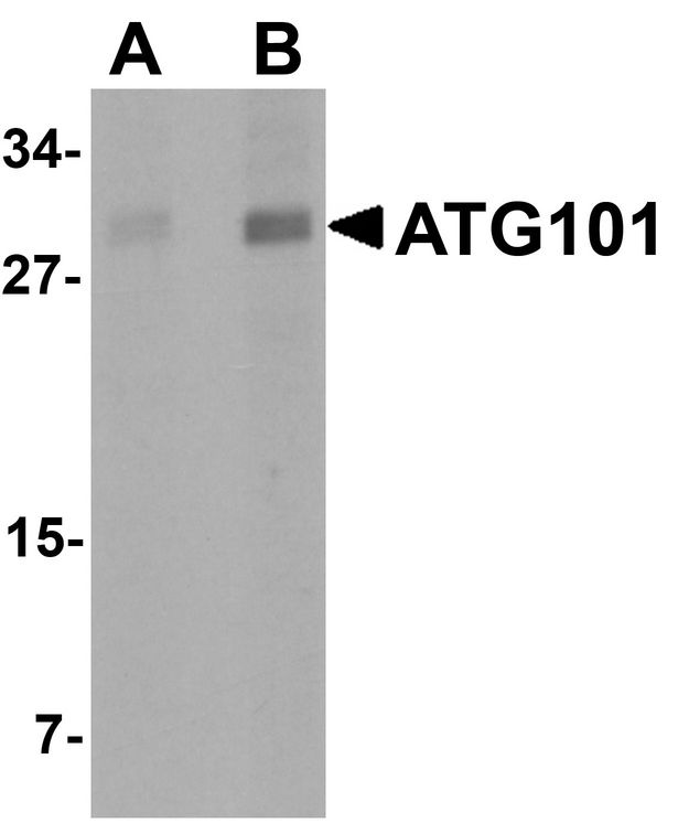 ATG101 Antibody - Western blot analysis of ATG101 in human liver tissue lysate with ATG101 antibody at (A) 1 and (B) 2 ug/ml.