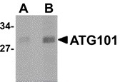 ATG101 Antibody - Western blot of human liver lysate probed with Rabbit anti-Human ATG101 at 1.0 (A) and 2.0 (B) uM