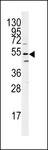 ATG14 Antibody - Western blot of ATG14 antibody in mouse heart tissue lysates (35 ug/lane). ATG14 (arrow) was detected using the purified antibody.