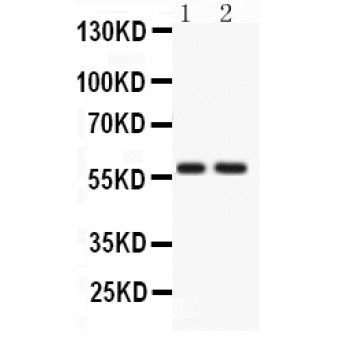 ATG14 Antibody - ATG14L antibody Western blot. All lanes: Anti ATG14L at 0.5 ug/ml. Lane 1: Rat Brain Tissue Lysate at 50 ug. Lane 2: HELA Whole Cell Lysate at 40 ug. Predicted band size: 59 kD. Observed band size: 59 kD.